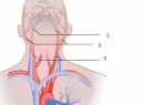 Анатомия. Общая сонная артерия