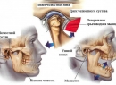 Воспаление челюстного сустава: причины и лечение