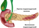 Панкреатит - Лечение народными методами