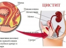 Лучшие свечи при цистите: обзор и отзывы