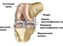 Что такое МРТ коленного сустава, как делают, что покажет МРТ коленного сустава?