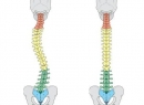 Сколиотическая осанка: признаки, причины, лечение и профилактика