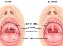 Фарингит и ларингит отличия, симптомы и методы лечения