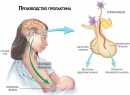 Гиперпролактинемия - симптомы повышенной выработки пролактина, последствия заболевания, диагностика и