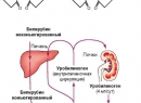 Болезнь Жильбера - симптомы недостатка билирубина в крови, лечение заболевания
