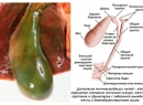 Дискинезия желчновыводящих путей