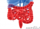 Колит - симптомы и лечение воспаления слизистой толстого кишечника