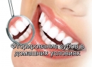 Покрытие эмали зубов фторлаком: польза и особенности обработки - лечение, эмаль, покрытие зубов, фторлак